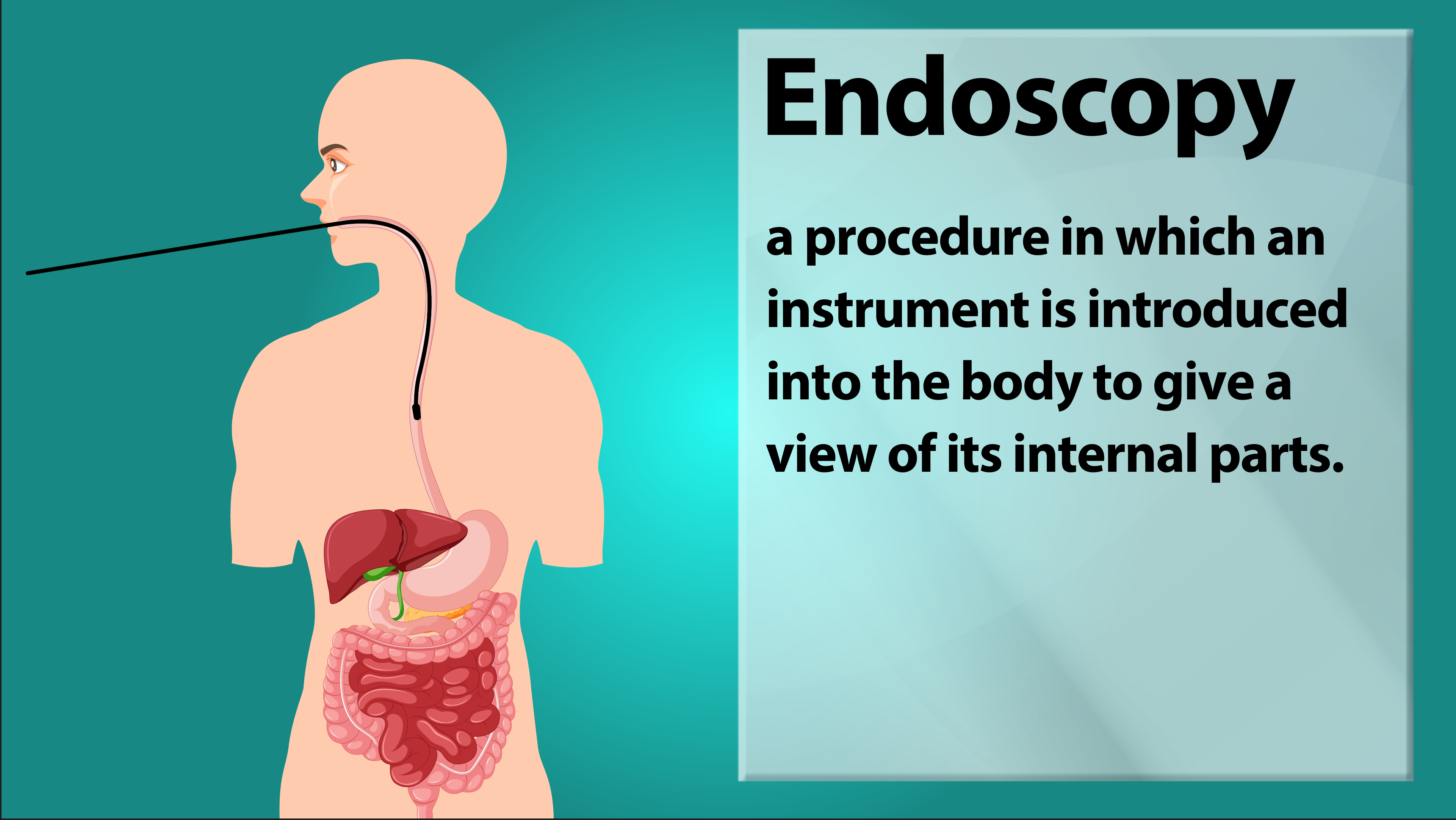 Endoscopy illustration — Faeth Therapeutics